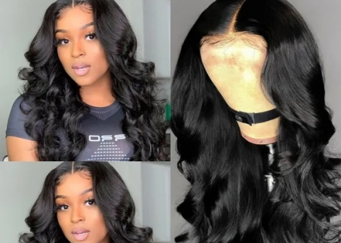 Hair Restoration Centre in Coconut Creek