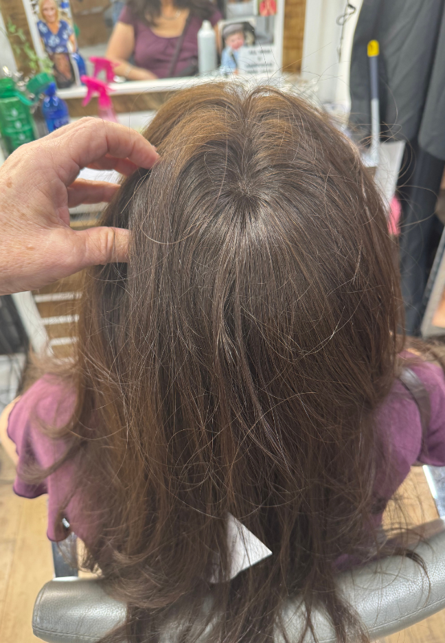 Hair toppers
